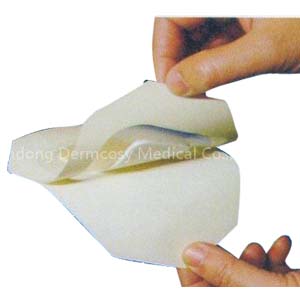 Opsite Flexifix Transparent Adhesive Film Dressing