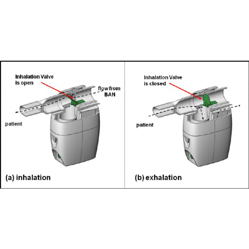 Aerobika Oscillating Positive Expiratory Pressure Therapy System