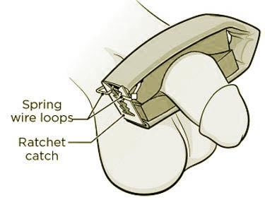 Cunningham Penile Incontinence Clamp, Regular