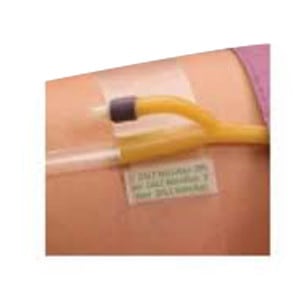Hold-n-Place Foley Catheter Holder Adhesive Patch, One Size Fits All