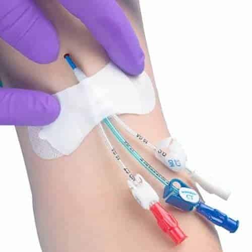 Grip-Lok Securement Device for Medium Universal Catheter and Tubing, 3-1/2", 1/8" - 5/16" Tubing